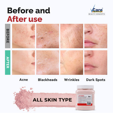 Vcare Jelly Whitening Peel Off Mask For Facials Skincare |Face Mask Powder 250g - Facial Skin Care Product for Women Smoothing, Moisturizing, Cleansing, Refreshing|Suits All Skin Types